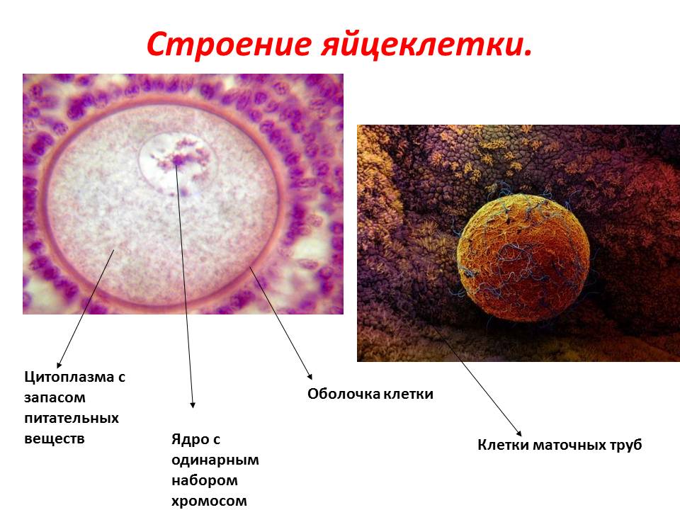 Спайки на яичниках картинки